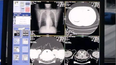 The AI-based diagnosis tool can identify 
Source: Alibaba