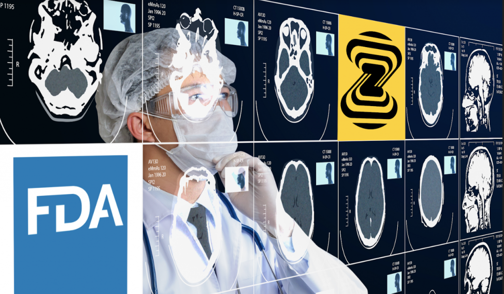 Zebra Medical Vision illustration. Image courtesy of Zebra Medical Vision via NoCamels.