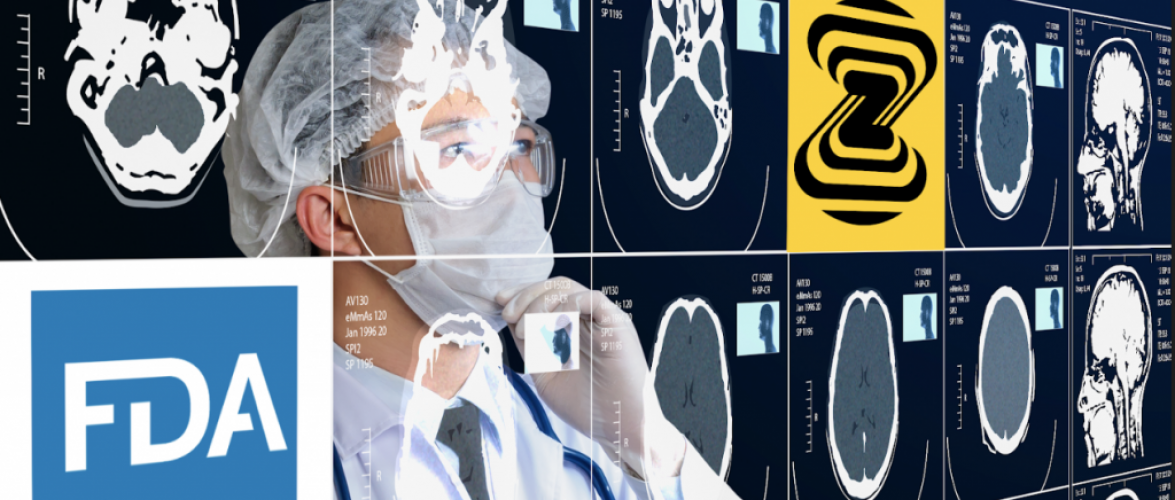 Zebra Medical Vision illustration. Image courtesy of Zebra Medical Vision via NoCamels.