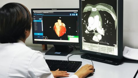 Shukun's AI screening systems. Photo provided to KrASIA