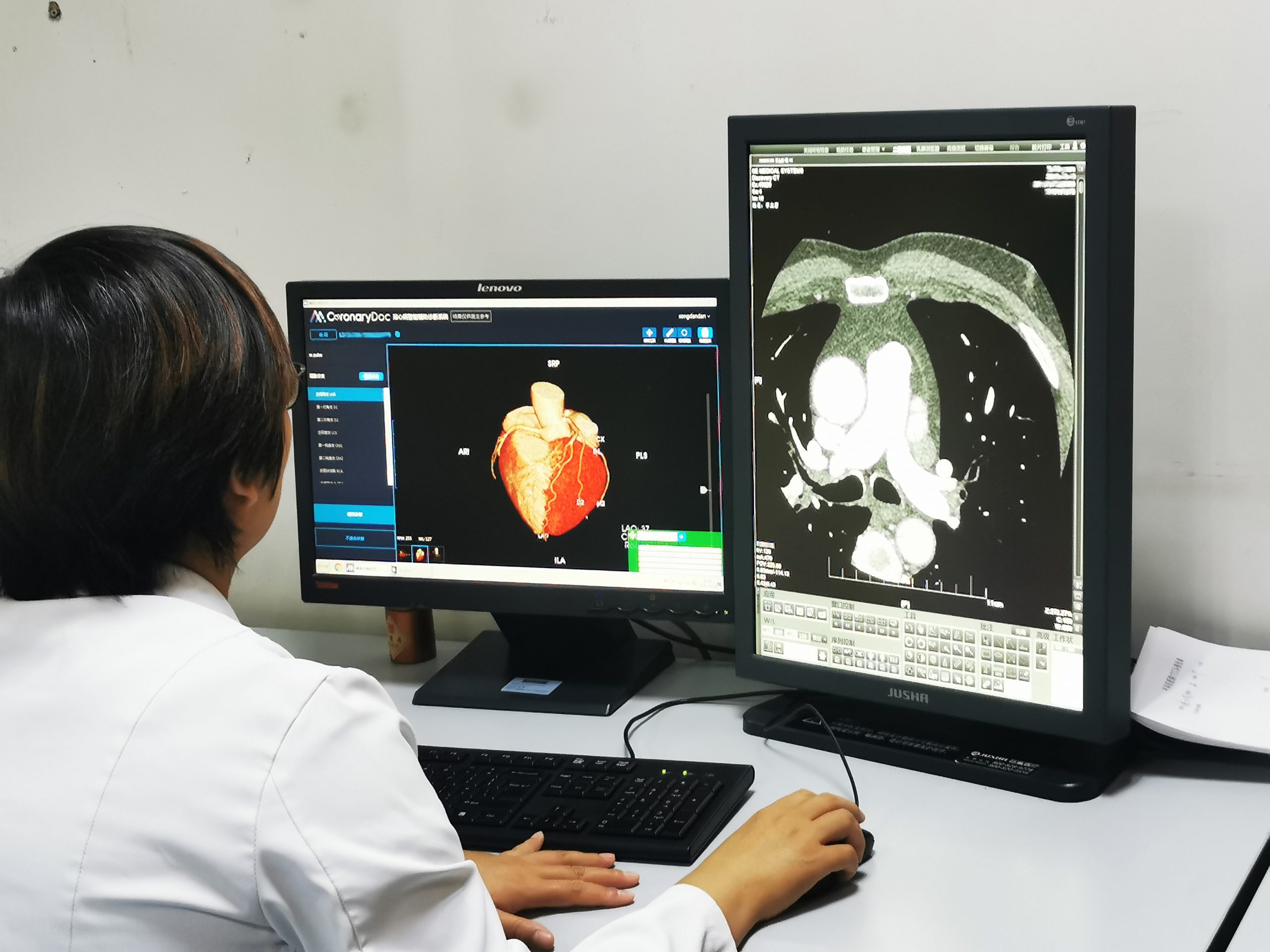 AI to boost doctors’ efficiency with imaging diagnostics: Inside China’s Startups