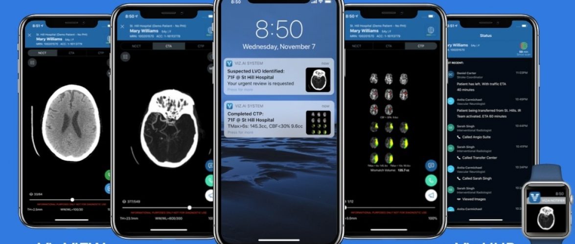 The different Viz.ai stroke detection platforms on various smartphones. Courtesy of Viz.ai via NoCamels.