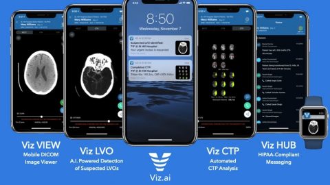 The different Viz.ai stroke detection platforms on various smartphones. Courtesy of Viz.ai via NoCamels.