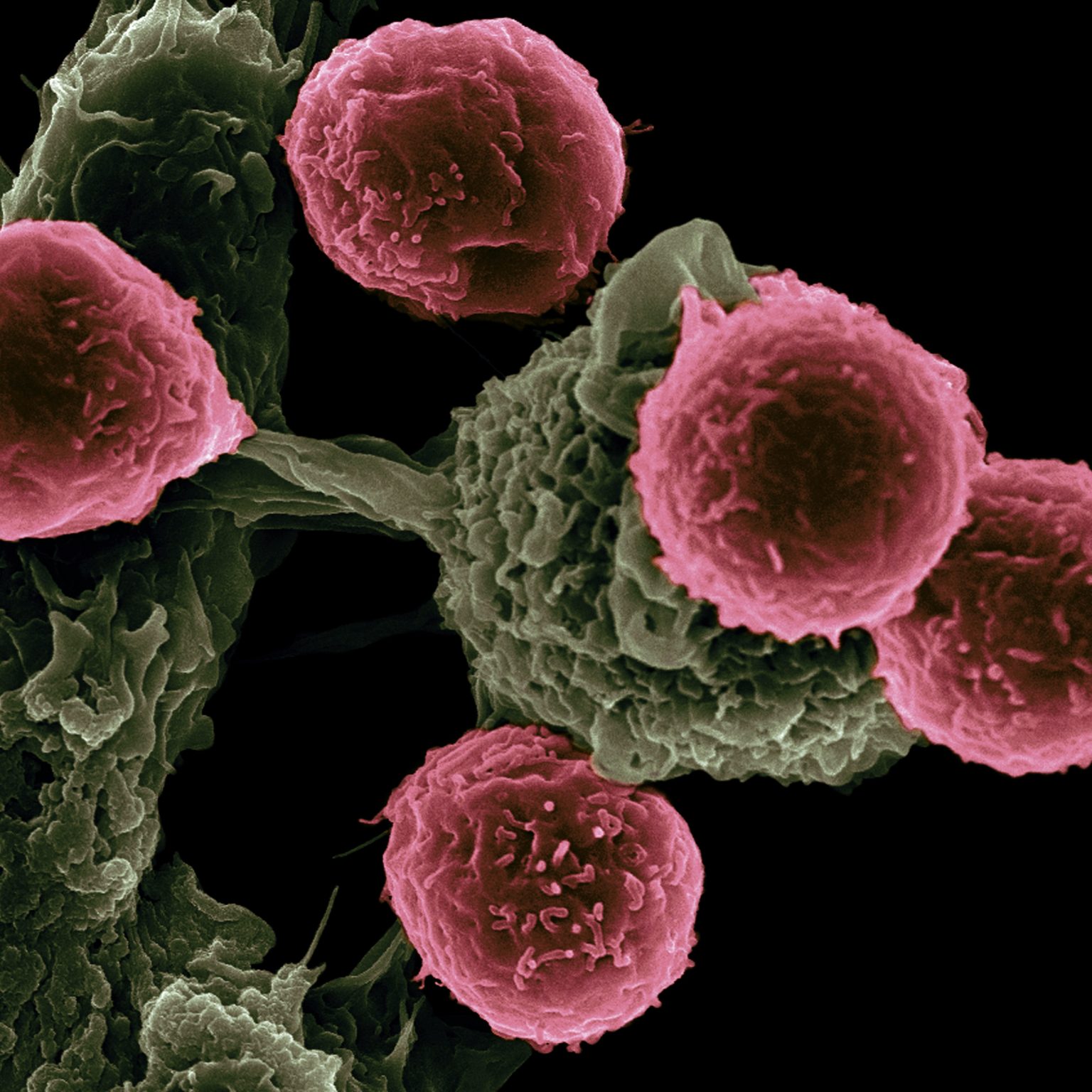 Vaccine-Based Immunotherapy from Novel Nanoparticle Systems. Researchers at the Texas Center for Cancer Nanomedicine (TCCN) are creating particle-based vaccines for cancer therapy. The particles carry molecules that stimulate immune cells and cancer antigens (proteins) that direct the immune response. This scanning electron microscope image shows dendritic cells, pseudo-colored in green, interacting with T cells, pseudo-colored in pink. The dendritic cells internalize the particles, process the antigens, and present peptides to T cells to direct immune responses. Photo by National Cancer Institute on Unsplash.