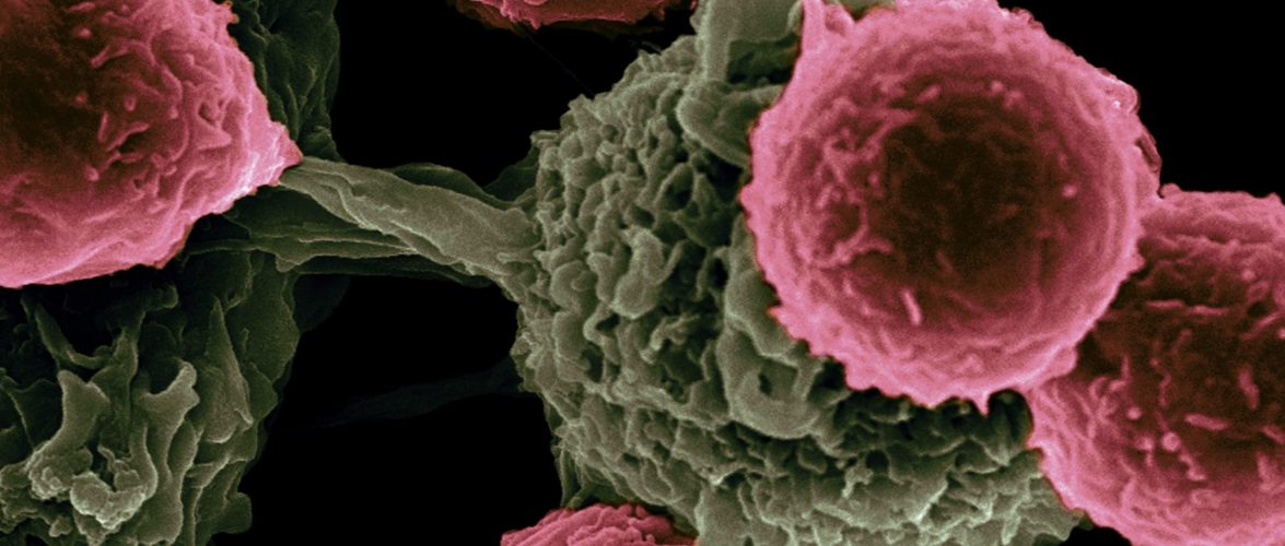 Vaccine-Based Immunotherapy from Novel Nanoparticle Systems. Researchers at the Texas Center for Cancer Nanomedicine (TCCN) are creating particle-based vaccines for cancer therapy. The particles carry molecules that stimulate immune cells and cancer antigens (proteins) that direct the immune response. This scanning electron microscope image shows dendritic cells, pseudo-colored in green, interacting with T cells, pseudo-colored in pink. The dendritic cells internalize the particles, process the antigens, and present peptides to T cells to direct immune responses. Photo by National Cancer Institute on Unsplash.