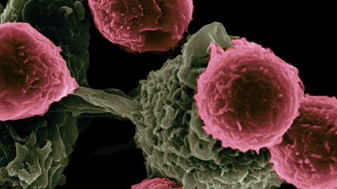 Vaccine-Based Immunotherapy from Novel Nanoparticle Systems. Researchers at the Texas Center for Cancer Nanomedicine (TCCN) are creating particle-based vaccines for cancer therapy. The particles carry molecules that stimulate immune cells and cancer antigens (proteins) that direct the immune response. This scanning electron microscope image shows dendritic cells, pseudo-colored in green, interacting with T cells, pseudo-colored in pink. The dendritic cells internalize the particles, process the antigens, and present peptides to T cells to direct immune responses. Photo by National Cancer Institute on Unsplash.
