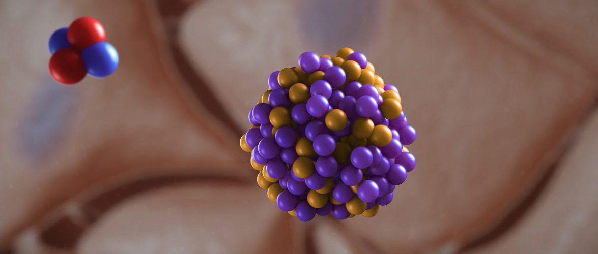 An illustration of Alpha Tau Medical's cancer therapy technology. Courtesy of Alpha Tau Medical via NoCamels.