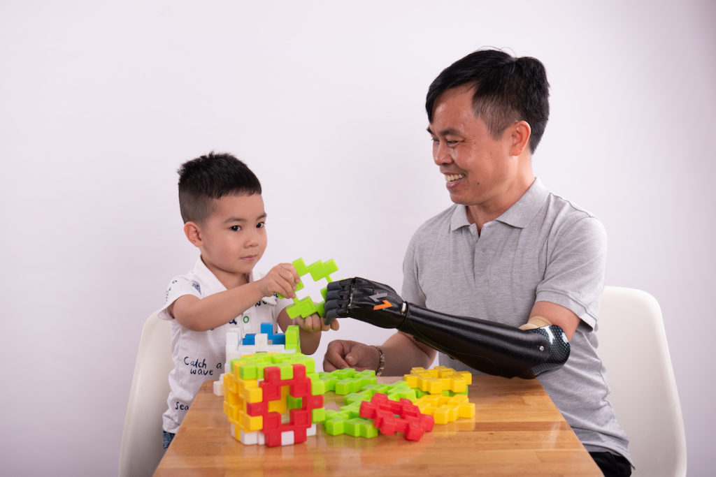 Vulcan Augmetics builds modular robotic prosthetic arms for amputees