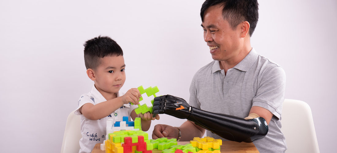 Vulcan Augmetics builds modular robotic prosthetic arms for amputees