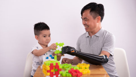 Vulcan Augmetics builds modular robotic prosthetic arms for amputees
