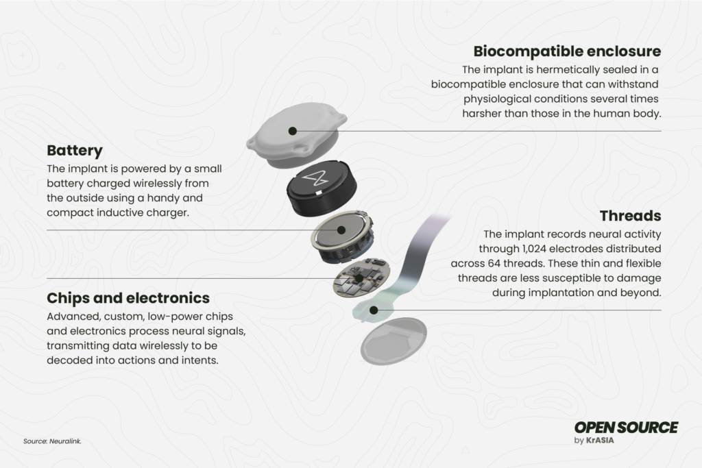 A diagram depicting the components of Neuralink’s N1 implant.