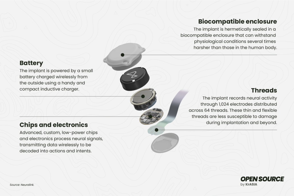 Neuralink: The Dawn of Digital Consciousness