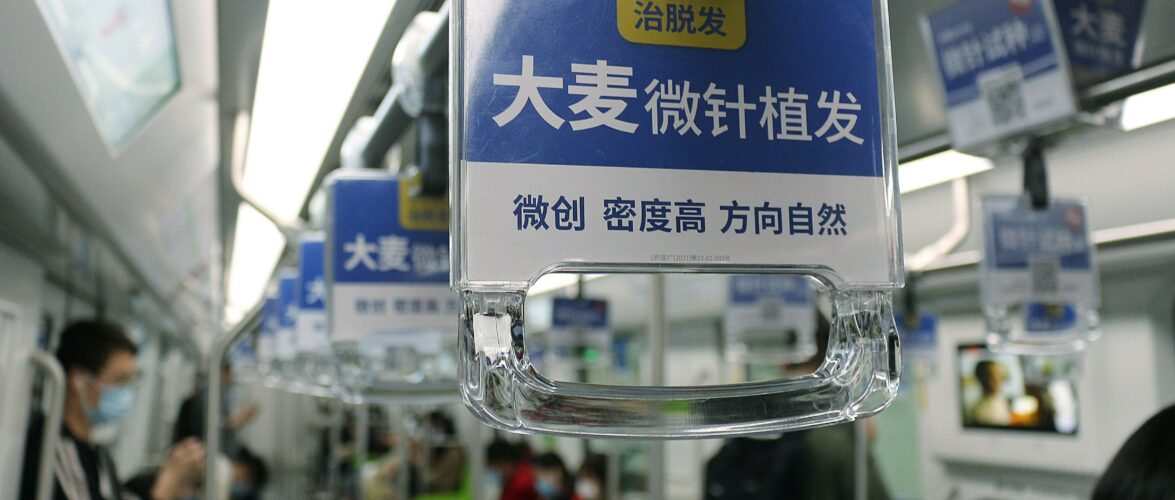 As China’s hair transplant boom fades, what comes next?