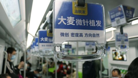 As China’s hair transplant boom fades, what comes next?